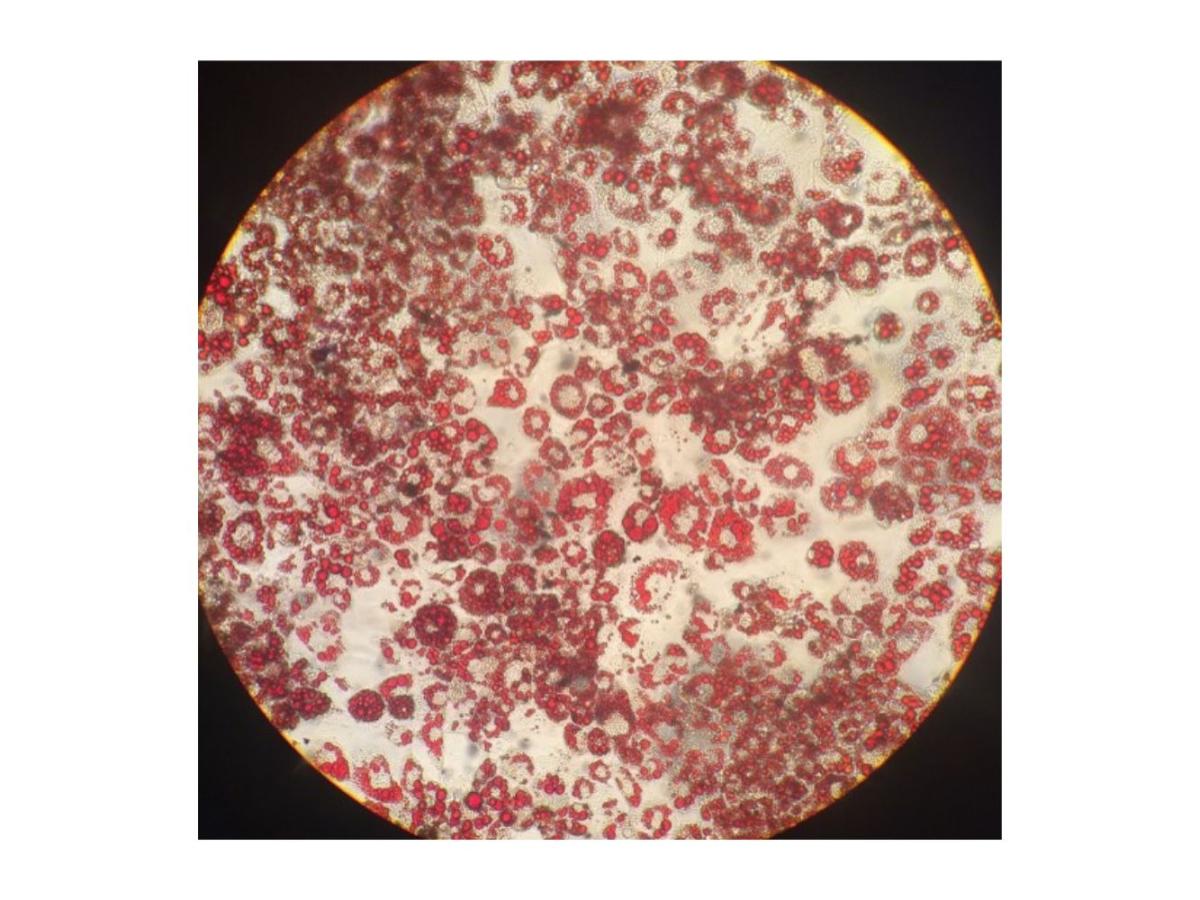 Lipid Accumulation into 3T3-L1 Adipocytes