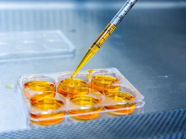 a dropper depositing yellow liquid in a test tray